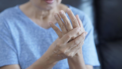 Learn How To Manage Your Rheumatoid Arthritis
